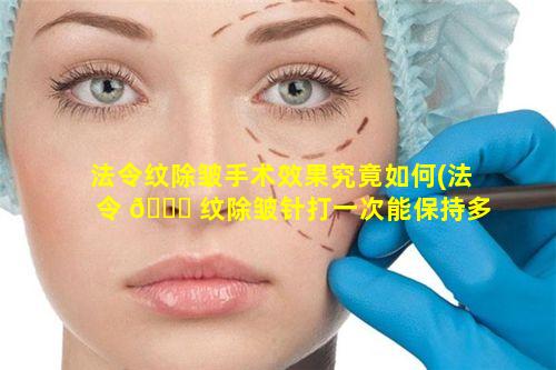 法令纹除皱手术效果究竟如何(法令 🍁 纹除皱针打一次能保持多久)